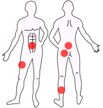 Muscoli sollecitati